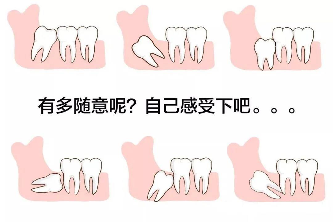 关于智齿的那些事儿