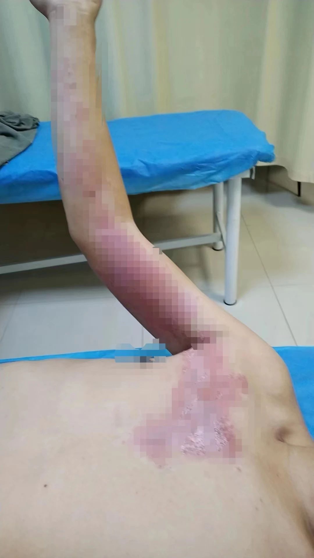 阜阳就诊人数明显增多！一旦感染疼痛难忍…